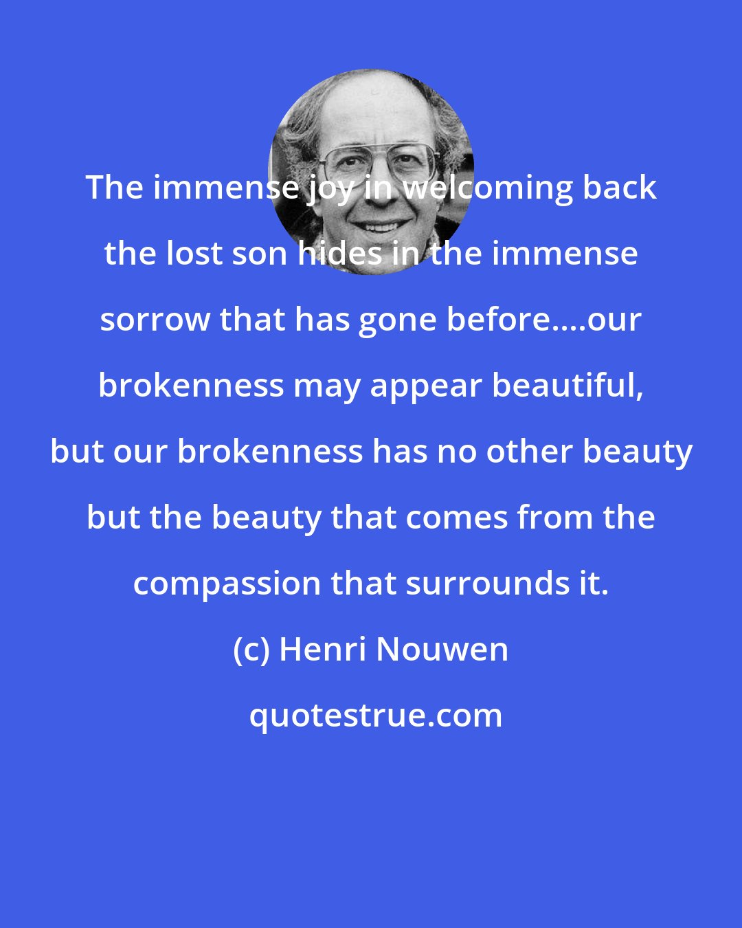 Henri Nouwen: The immense joy in welcoming back the lost son hides in the immense sorrow that has gone before....our brokenness may appear beautiful, but our brokenness has no other beauty but the beauty that comes from the compassion that surrounds it.