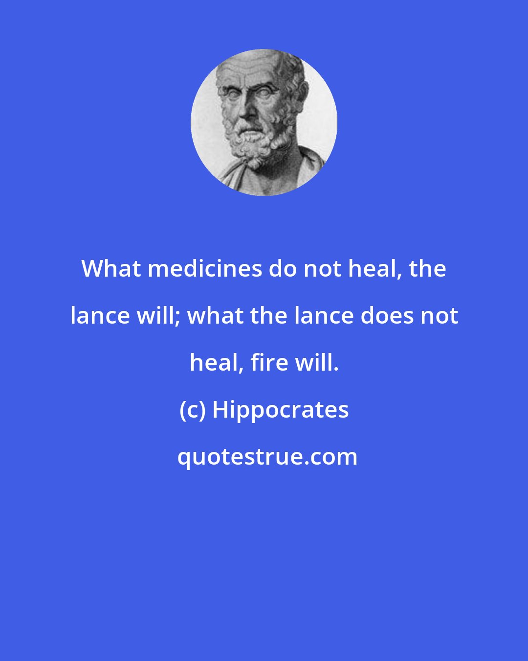 Hippocrates: What medicines do not heal, the lance will; what the lance does not heal, fire will.