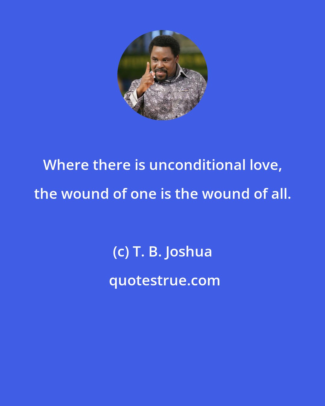 T. B. Joshua: Where there is unconditional love, the wound of one is the wound of all.