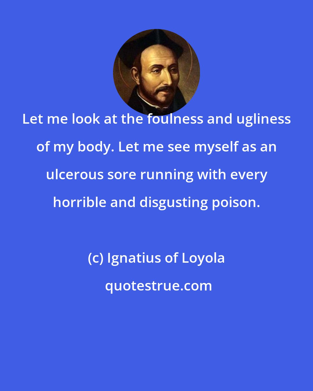 Ignatius of Loyola: Let me look at the foulness and ugliness of my body. Let me see myself as an ulcerous sore running with every horrible and disgusting poison.