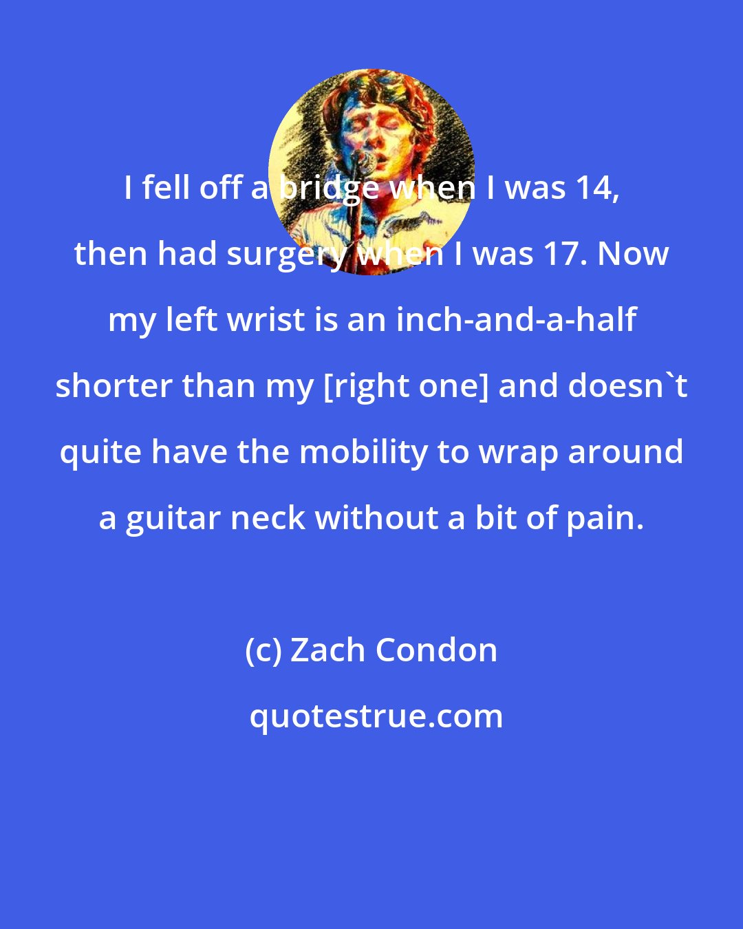 Zach Condon: I fell off a bridge when I was 14, then had surgery when I was 17. Now my left wrist is an inch-and-a-half shorter than my [right one] and doesn't quite have the mobility to wrap around a guitar neck without a bit of pain.