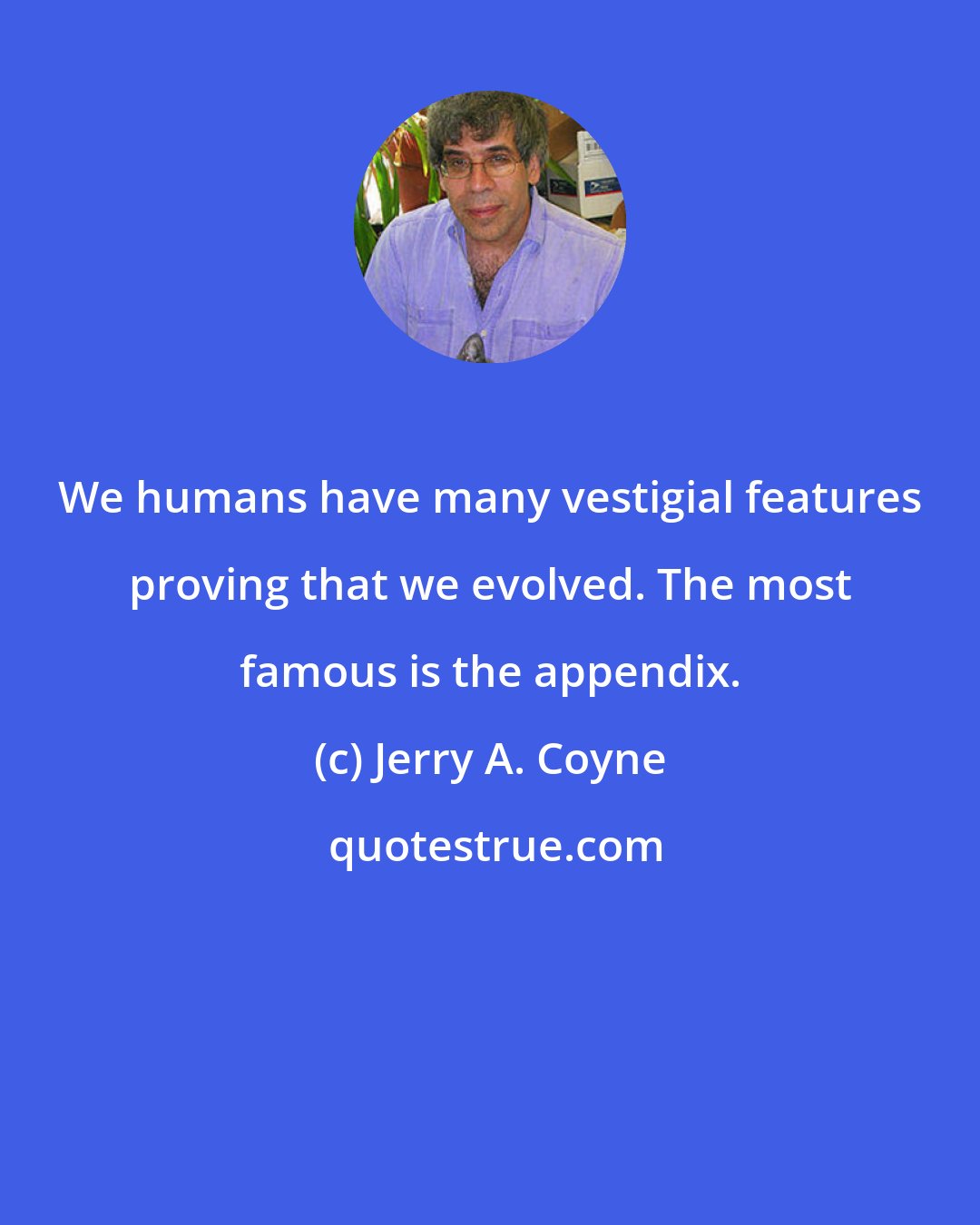 Jerry A. Coyne: We humans have many vestigial features proving that we evolved. The most famous is the appendix.