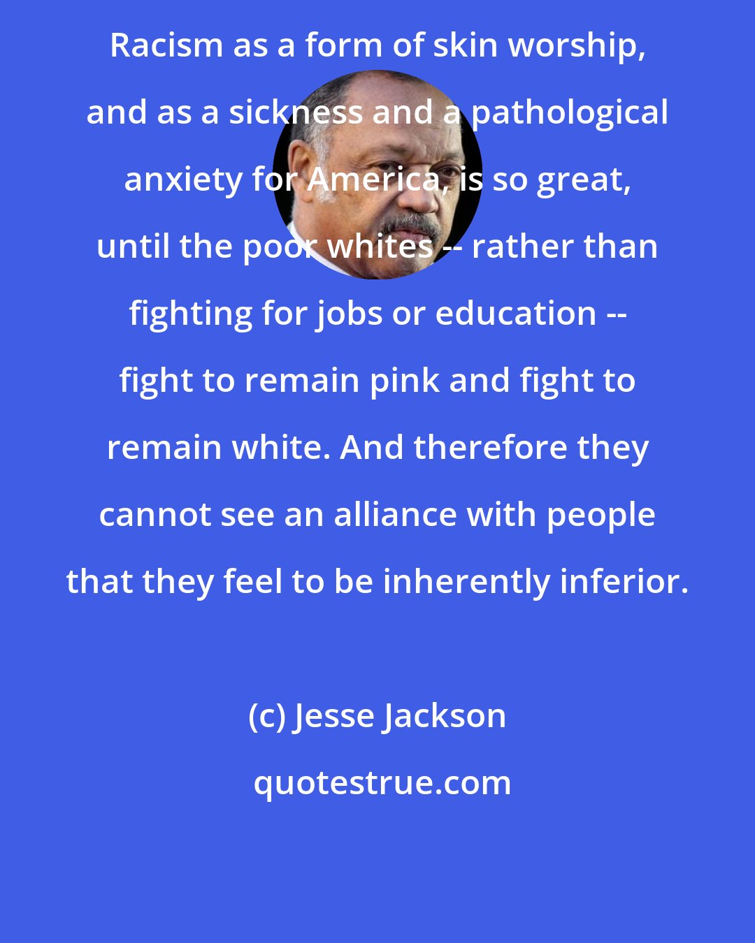 Jesse Jackson: Racism as a form of skin worship, and as a sickness and a pathological anxiety for America, is so great, until the poor whites -- rather than fighting for jobs or education -- fight to remain pink and fight to remain white. And therefore they cannot see an alliance with people that they feel to be inherently inferior.