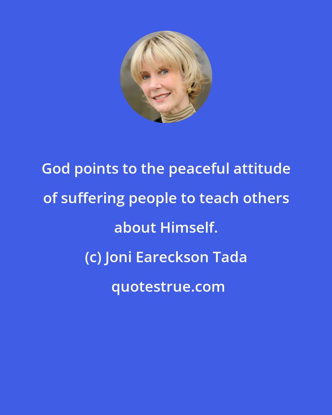 Joni Eareckson Tada: God points to the peaceful attitude of suffering people to teach others about Himself.