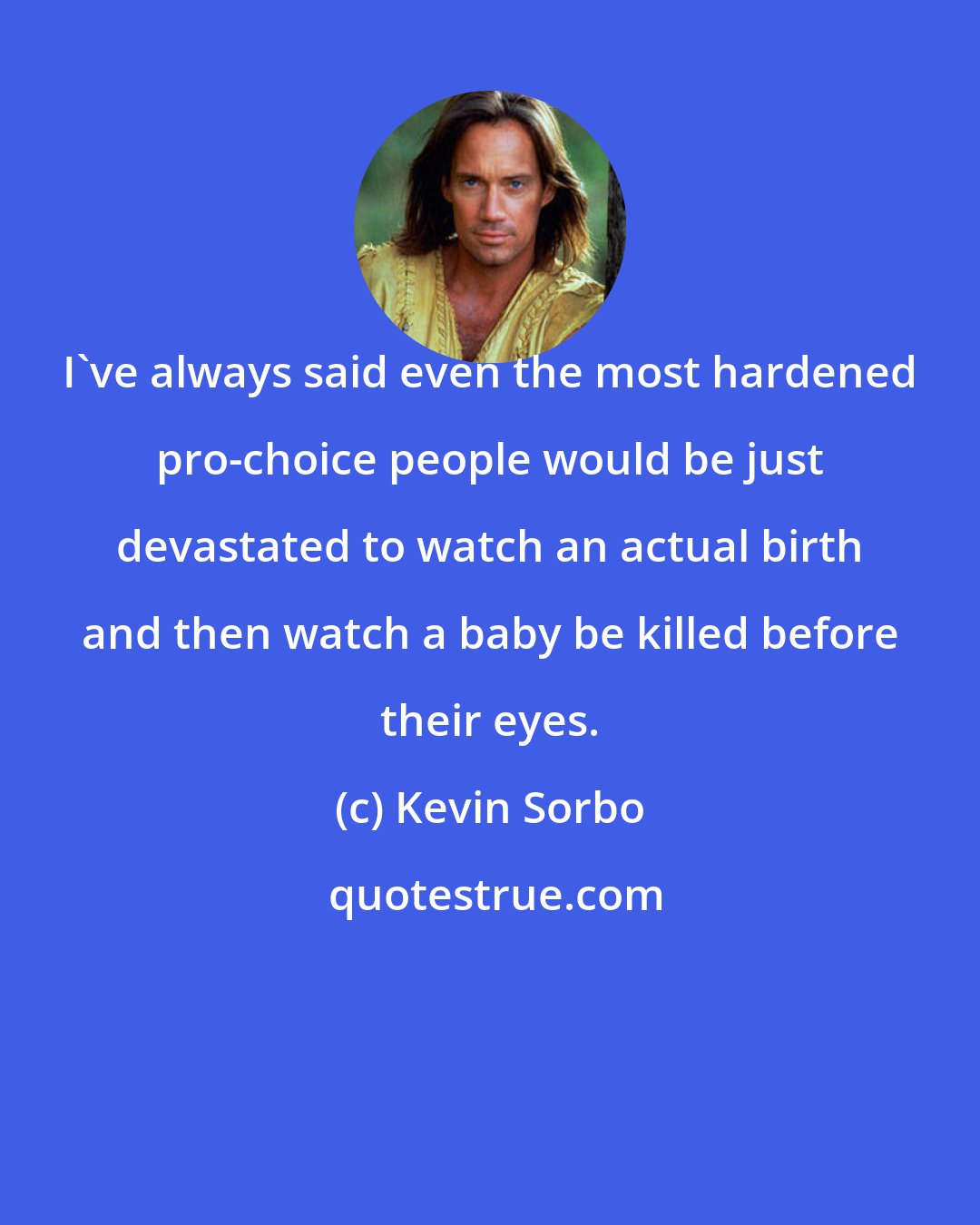 Kevin Sorbo: I've always said even the most hardened pro-choice people would be just devastated to watch an actual birth and then watch a baby be killed before their eyes.