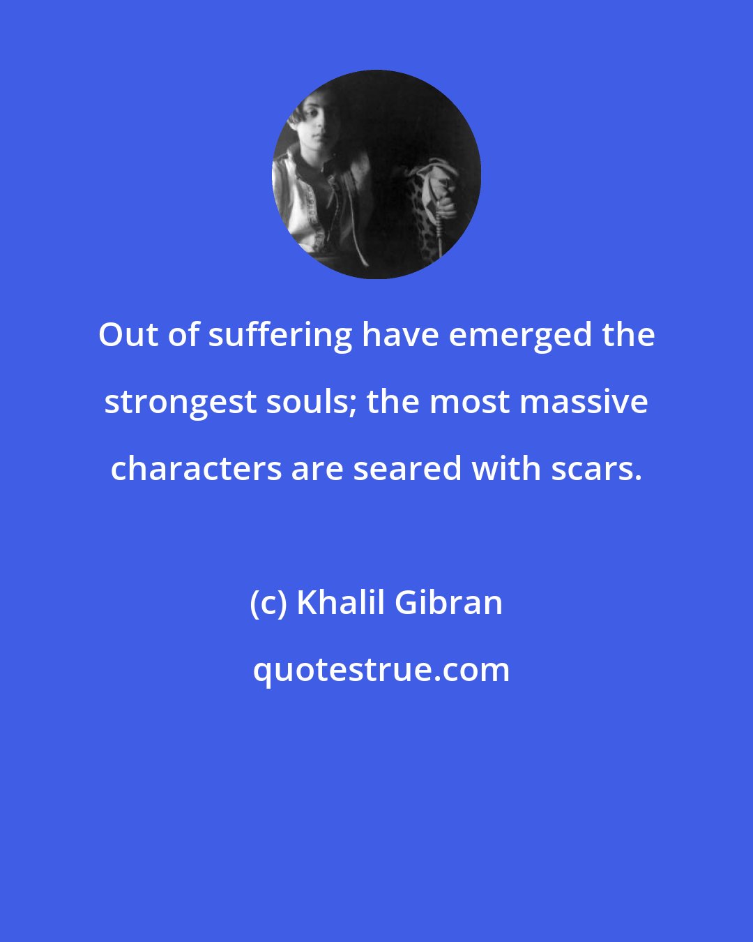 Khalil Gibran: Out of suffering have emerged the strongest souls; the most massive characters are seared with scars.