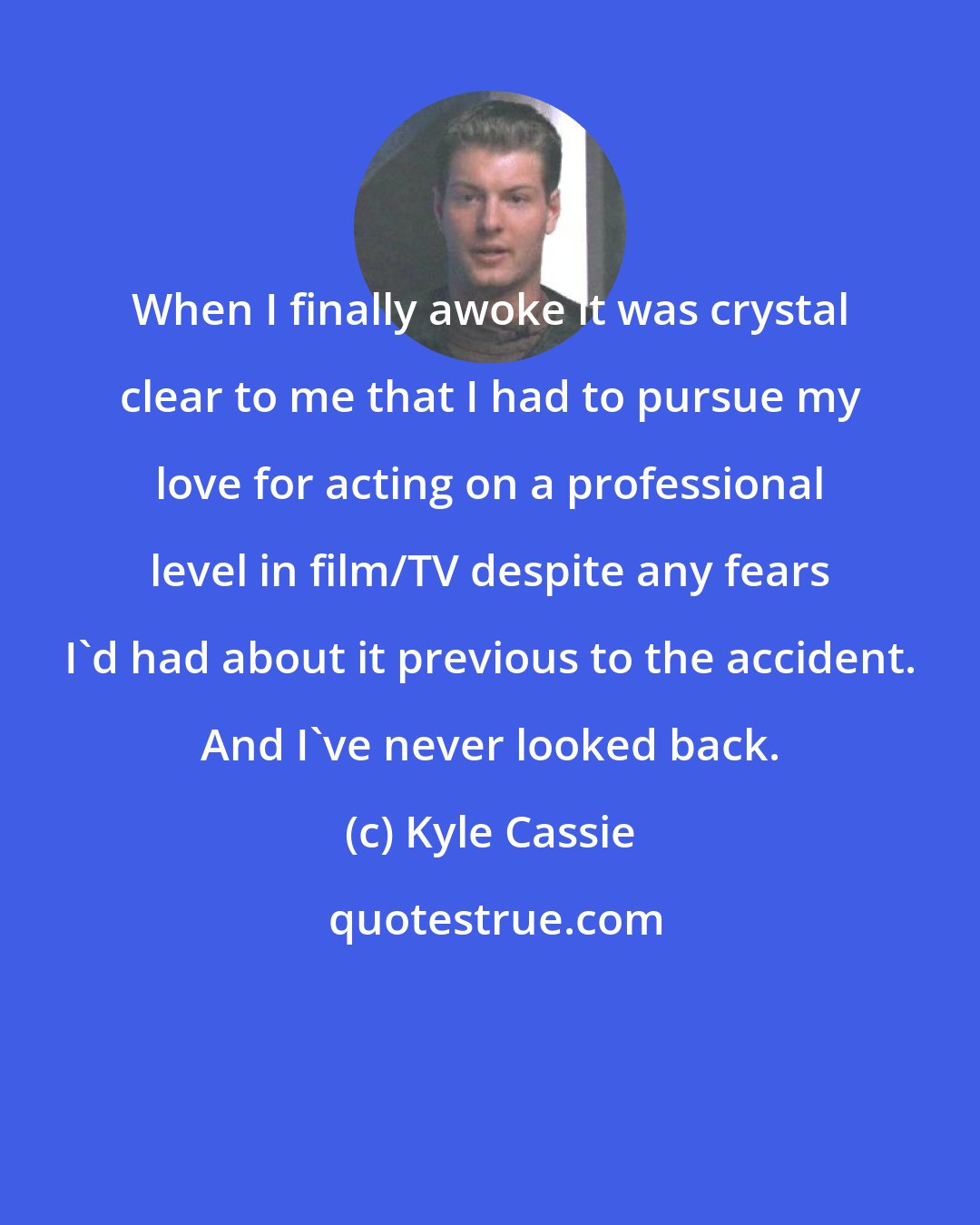 Kyle Cassie: When I finally awoke it was crystal clear to me that I had to pursue my love for acting on a professional level in film/TV despite any fears I'd had about it previous to the accident. And I've never looked back.