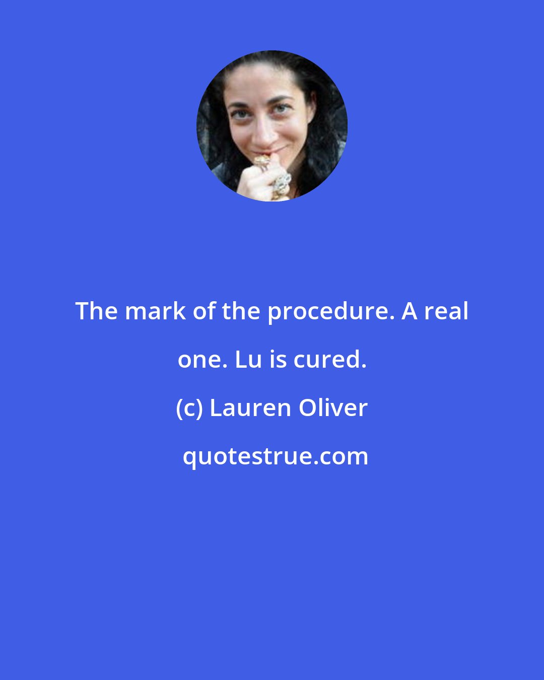 Lauren Oliver: The mark of the procedure. A real one. Lu is cured.