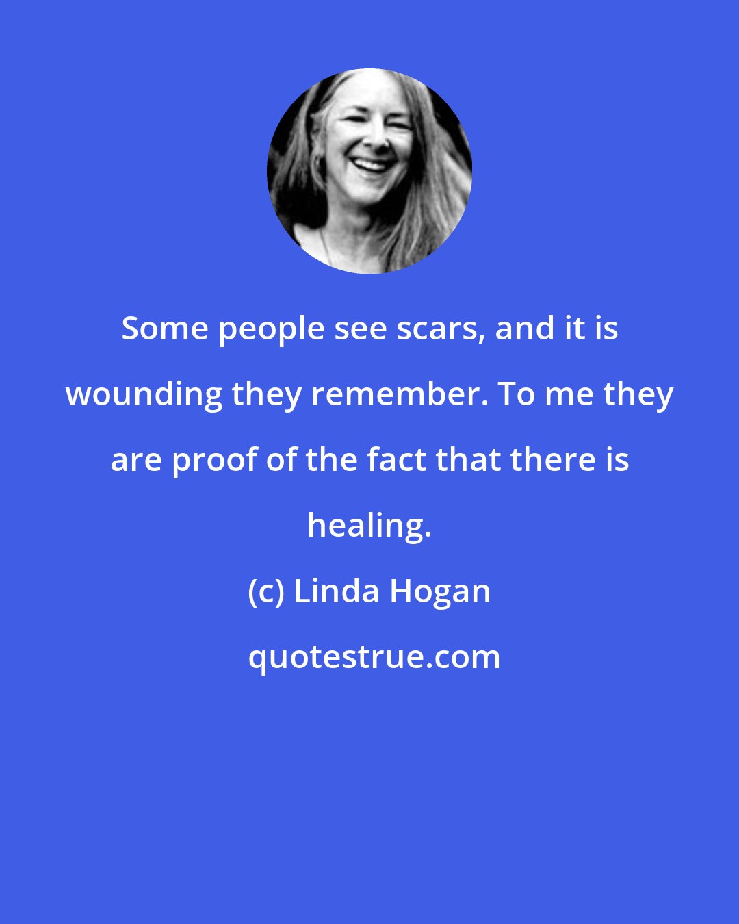 Linda Hogan: Some people see scars, and it is wounding they remember. To me they are proof of the fact that there is healing.