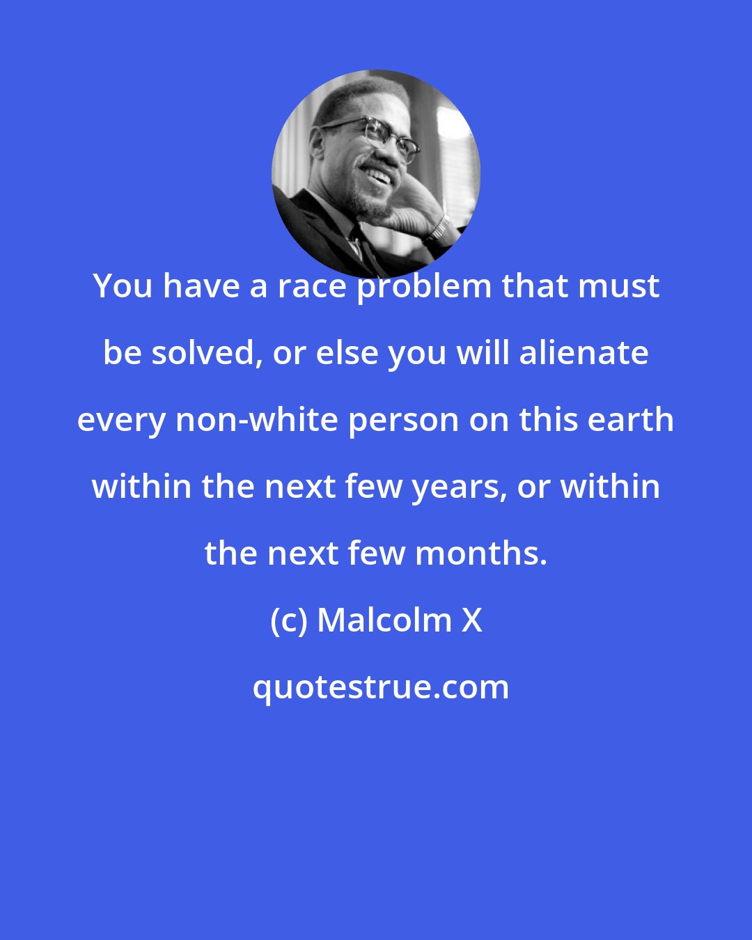 Malcolm X: You have a race problem that must be solved, or else you will alienate every non-white person on this earth within the next few years, or within the next few months.