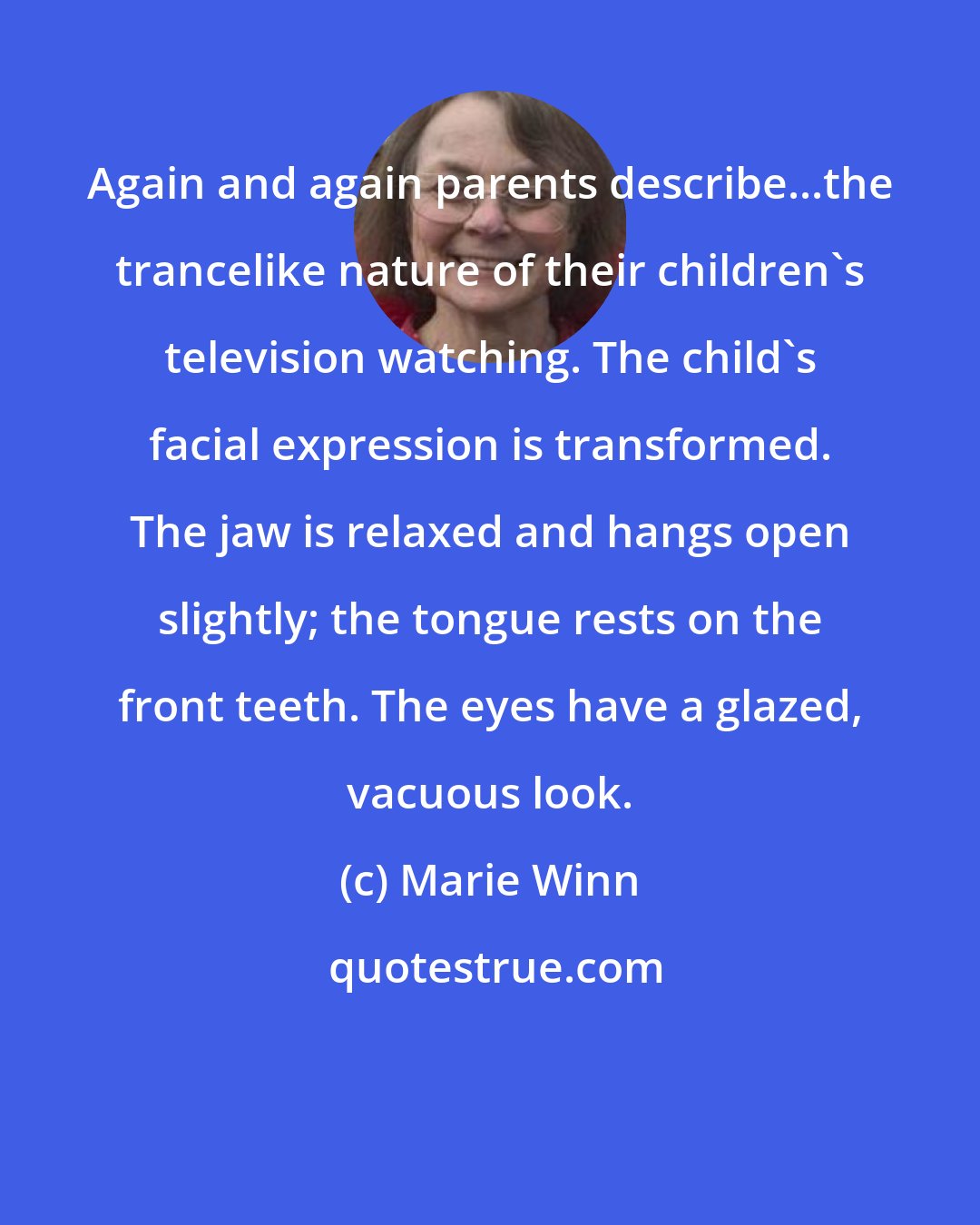 Marie Winn: Again and again parents describe...the trancelike nature of their children's television watching. The child's facial expression is transformed. The jaw is relaxed and hangs open slightly; the tongue rests on the front teeth. The eyes have a glazed, vacuous look.