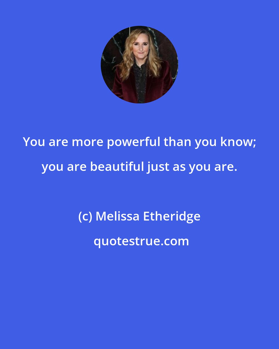 Melissa Etheridge: You are more powerful than you know; you are beautiful just as you are.