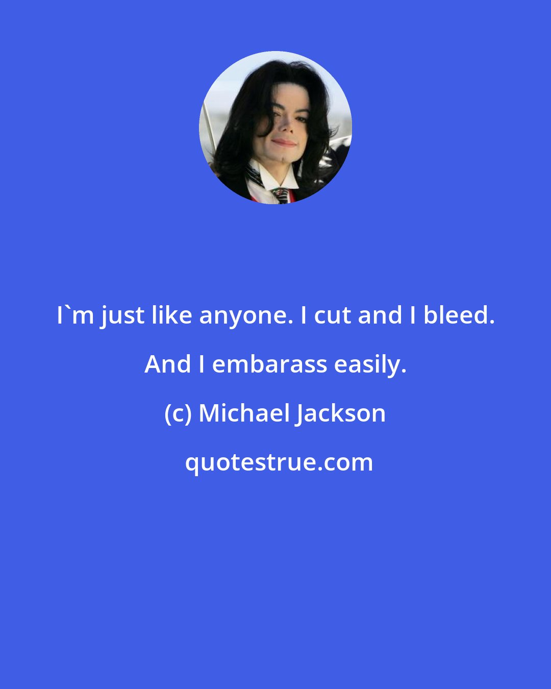 Michael Jackson: I'm just like anyone. I cut and I bleed. And I embarass easily.